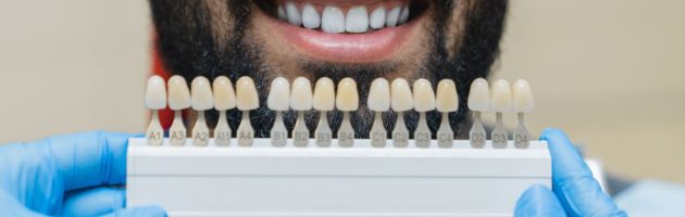 How Veneers Can Enhance Aesthetics and Confidence for Londoners